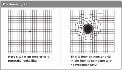 Amsler grid basic version with dot in center Vector Image